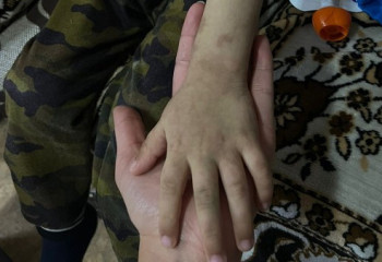 Кокшетауская полиция расследует жестокое обращение с пятилетним мальчиком