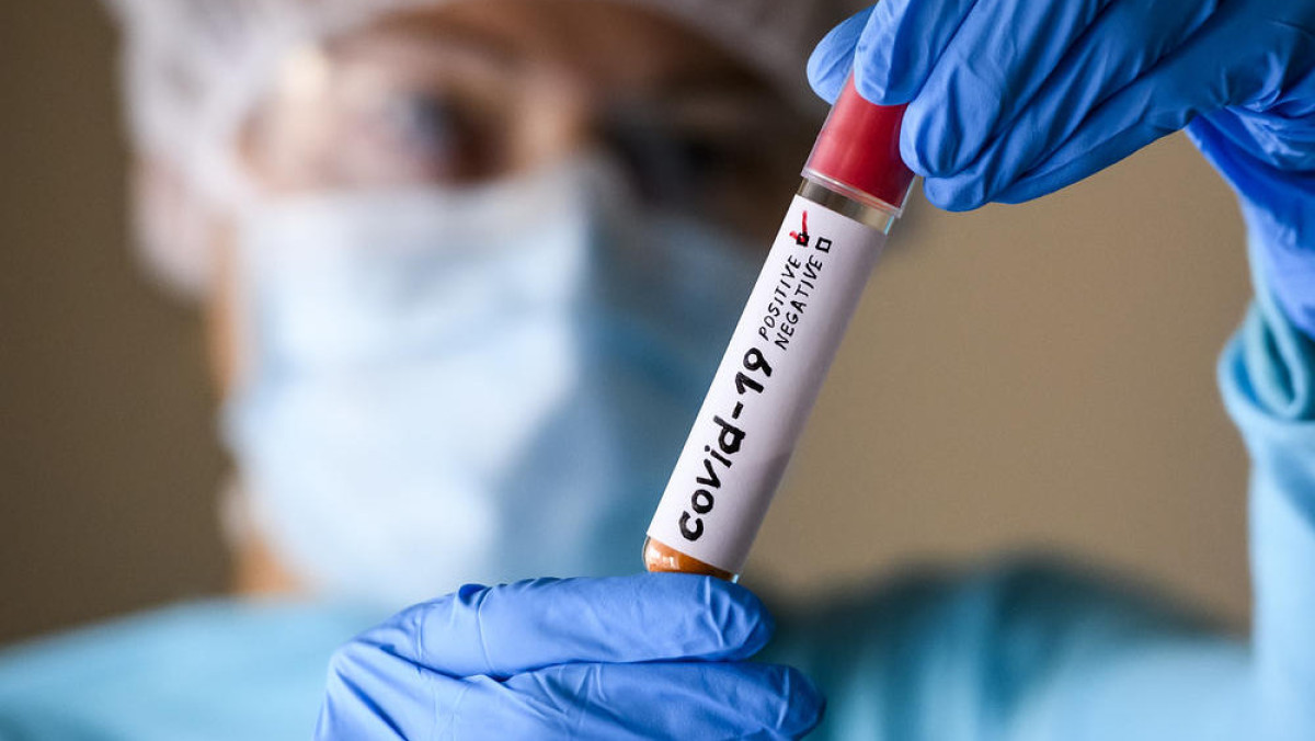 38 человек заболели коронавирусом в РК за сутки
