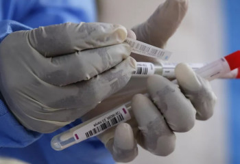 Өткен тәулікте 85 адамнан коронавирус анықталды