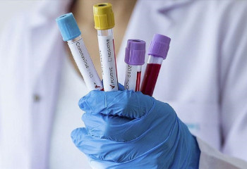 В Казахстане растет заболеваемость коронавирусом