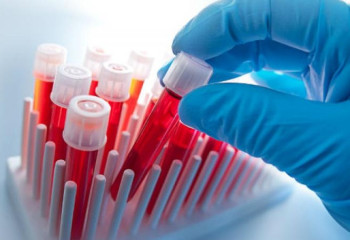 Өткен тәулікте 167 адам коронавирус жұқтырды