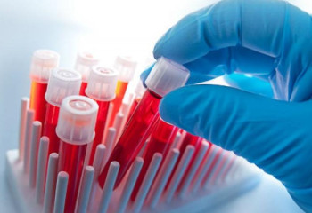 Бір тәулікте 173 қазақстандық коронавирус жұқтырды