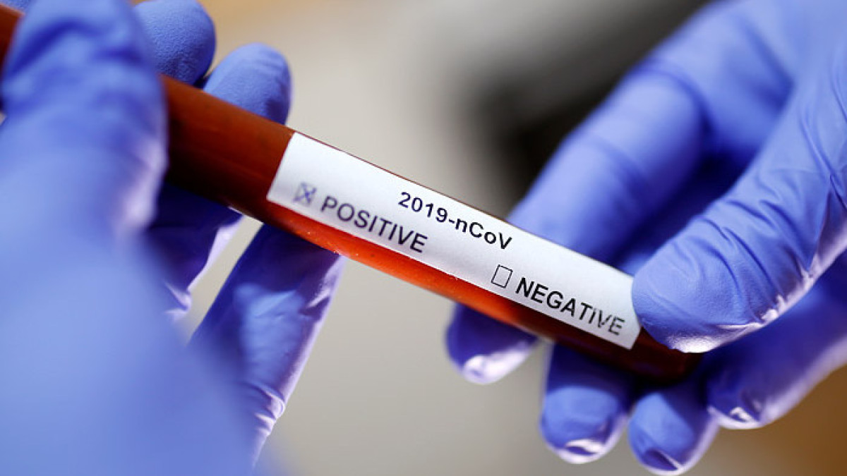 Больше 1,3 тыс человек в РК получают лечение от коронавируса