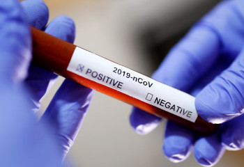 Больше 1,3 тыс человек в РК получают лечение от коронавируса