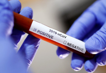 Over 1,2 kazakhstanis getting treatment for Covid-19