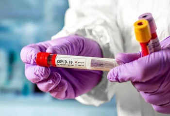 Almost 200 kazakhstanis getting hospital treatment for Covid-19