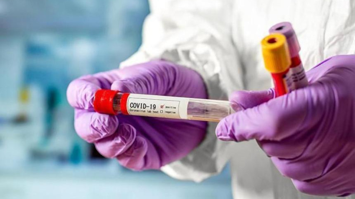  coronavirus2020.kz 