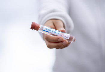 Елімізде коронавирус жұқтырғандар саны артты