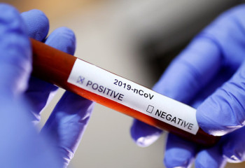 Number of Covid-19 cases continues to grow in Kazakhstan