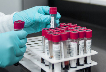 В РК вновь увеличилось количество заболевших коронавирусом