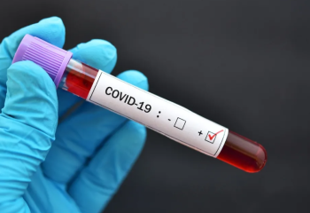 Бір күнде 279 адамнан коронавирус анықталды