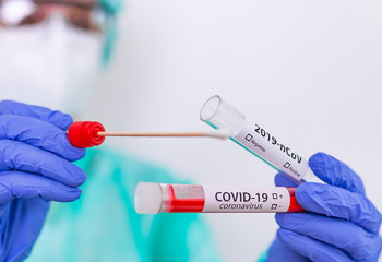 Елімізде коронавирус жұқтырғандар саны артты