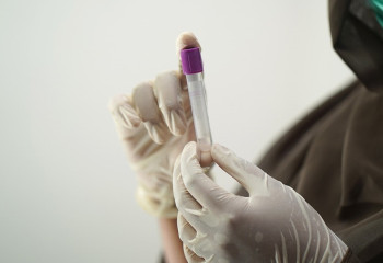 Бір күнде 140 адамнан коронавирус анықталды