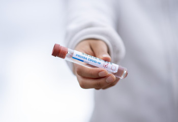 Коронавирус инфекциясынан 2 215 адам емделуде