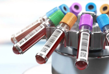 Бір күнде 282 адамнан коронавирус анықталды