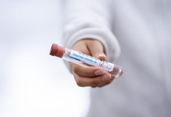 Өткен тәулікте 271 адамнан коронавирус инфекциясы табылды