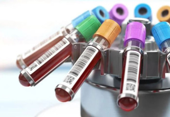 Өткен тәулікте 231 адамнан коронавирус инфекциясы анықталды