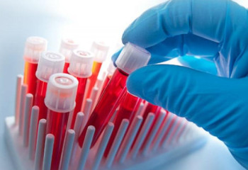 Қазақстанда бір тәулікте 202 адам коронавирус жұқтырған