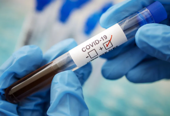 Елімізде екі мыңнан аса адам коронавирустан емделіп жатыр