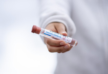 Өткен тәулікте елімізде 87 адамнан коронавирус инфекциясы анықталды