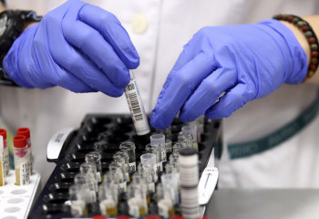 Қазақстанда коронавирус жұқтырғандар саны қайта көбейіп жатыр