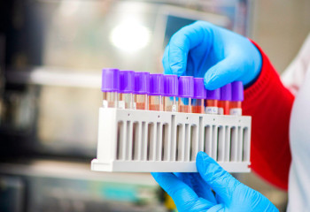 Өткен тәулікте 70 адамнан коронавирус инфекциясы анықталды