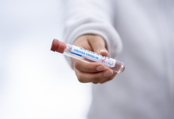 Өткен тәулікте 56 адам коронавирус жұқтырды