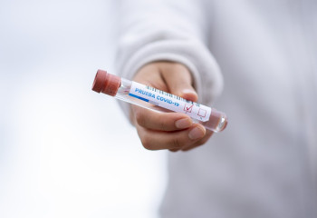 Қазақстанда коронавирус жұқтырғандар азайып келеді