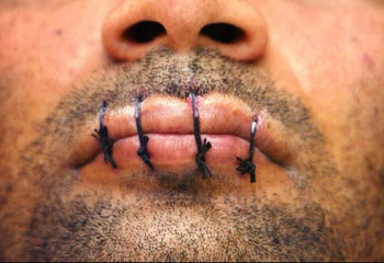 Зашили рты и объявили голодовку: Пациенты психбольницы в Актау заявили о нарушении своих прав