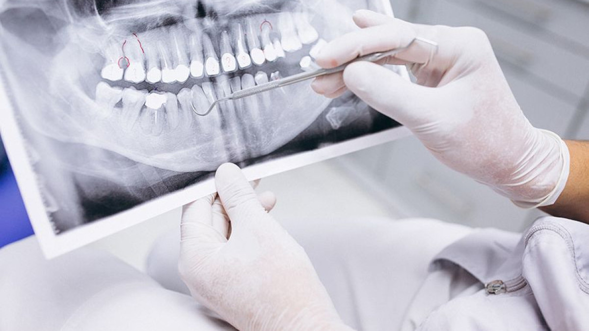 МӘМС есебінен стоматологиялық көмек бойынша ТОП-10 сауал