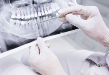 МӘМС есебінен стоматологиялық көмек бойынша ТОП-10 сауал