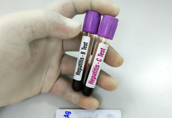 Астанада вирустық гепатитті элиминациялау бойынша пилоттық бағдарлама іске қосылды