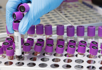 Өткен тәулікте 27 адамнан коронавирус анықталды