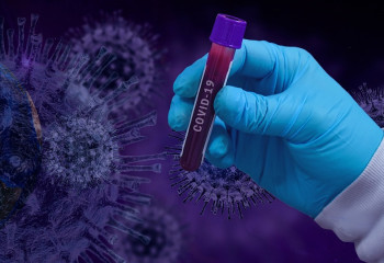 Өткен тәулікте 47 адамнан коронавирус инфекциясы анықталды