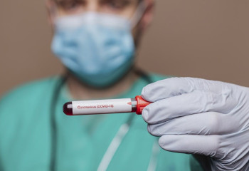 Өткен тәулікте 63 адамнан коронавирус анықталды