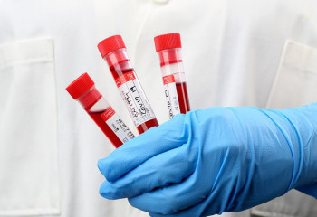 Өткен тәулікте 67 адамнан коронавирус анықталды