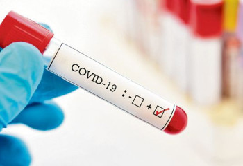 New 48 COVID-19 cases reported in Kazakhstan