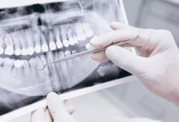 Более 60 стоматологических клиник в Астане оказывают помощь в рамках медстрахования