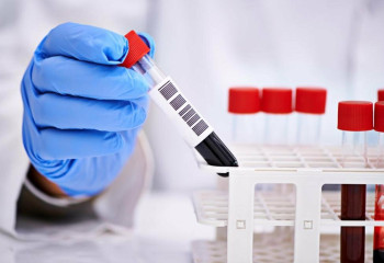 Бір тәулікте 97 адамнан коронавирус анықталды