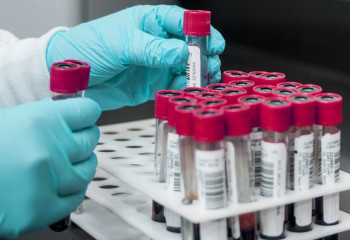 Өткен тәулікте 38 адамнан коронавирус анықталды