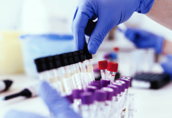 Өткен тәулікте 58 адамнан коронавирус инфекциясы анықталды