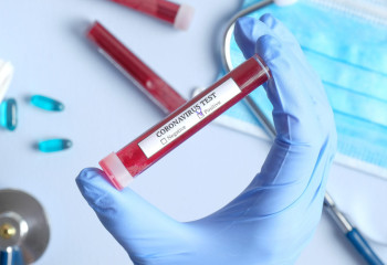 Өткен тәулікте 44 адамнан коронавирус анықталды