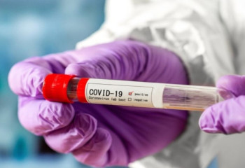 Кеше коронавирус жұқтырғандар саны 100-ден асты