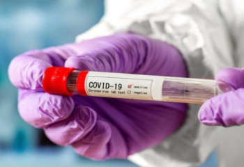 Кеше 85 адамнан коронавирус анықталды