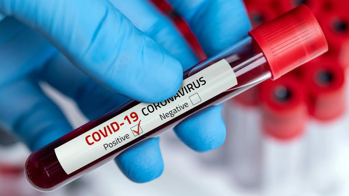 Өткен тәулікте 36 адамнан коронавирус анықталды