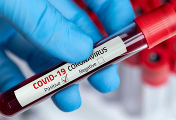 Өткен тәулікте 36 адамнан коронавирус анықталды