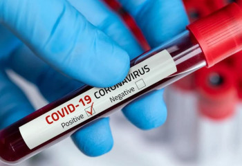 Бір күнде 70 адамнан коронавирус анықталды