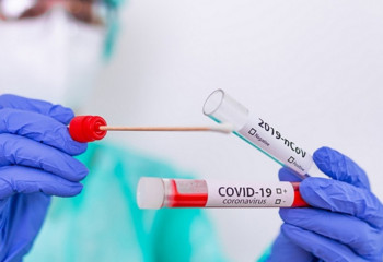 Қазақстанда коронавирус жұқтырғандар саны азайды