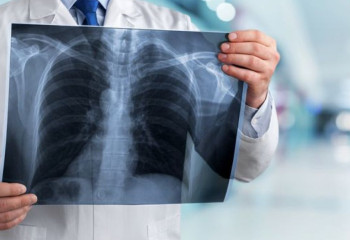 Снизилась заболеваемость туберкулезом в Астане