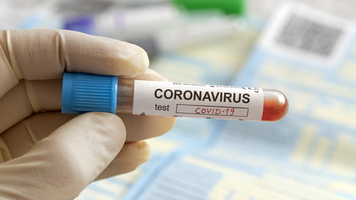 Елімізде бір тәулікте 34 адамнан коронавирус анықталды
